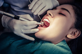 https://www.davislakedental.com/wp-content/uploads/2024/03/davis-thmb05.jpg